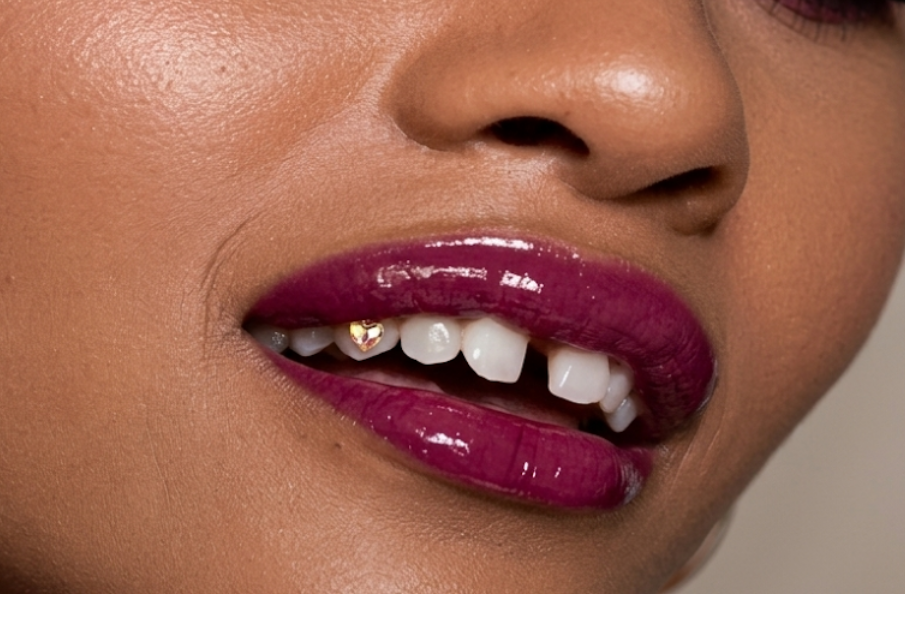 Real client result - smile